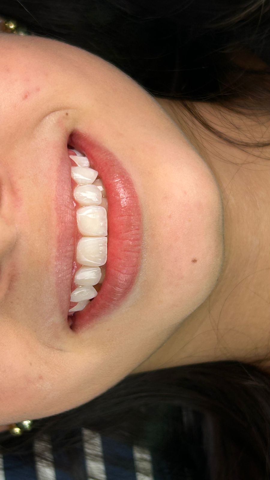 Blanqueamiento dental Lux Dent Sogamoso