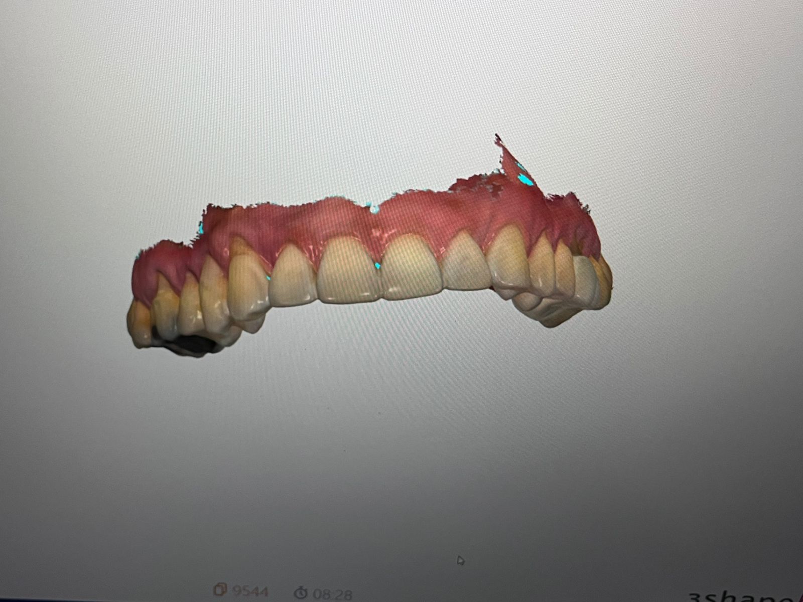 Rehabilitación Oral Lux Dent Sogamoso